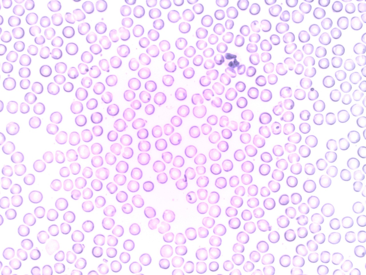 blood, neutrophil, segmented neutrophil